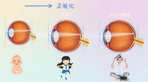 7亿中国人近视！到底是基因的突变？还是环境的变化？