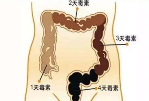 怎样看拉出来的是宿便