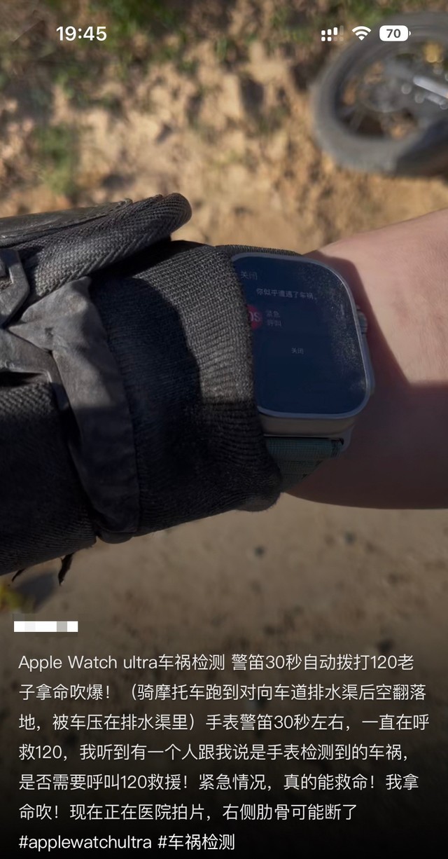 apple watch ultra