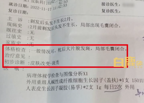 家长注意！宝宝剃胎毛后局部毛囊闭合难长头发：或需植发治疗